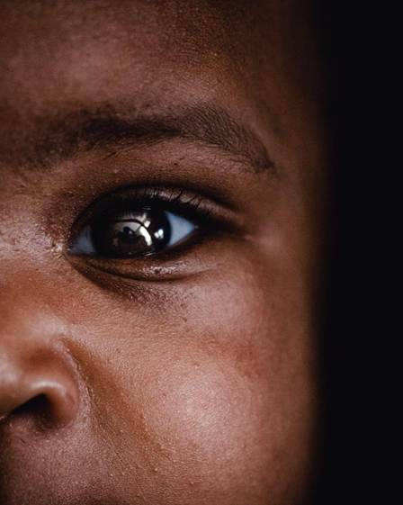 Close-up of a child's face, focusing on the eye and part of the cheek, revealing dark skin and expressive features.